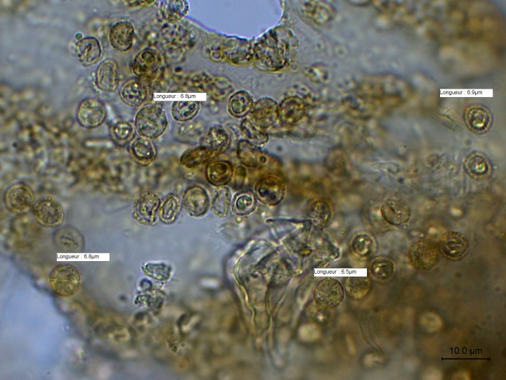 spores de Cribaria argillacea (Myxomycètes)